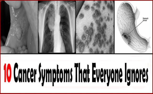 10 Cancer Symptoms You Keep On Ignoring