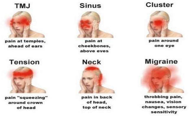 how-to-recognize-which-headache-is-dangerous