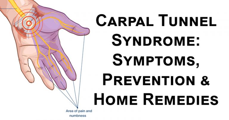 Carpal Tunnel Syndrome: Symptoms, Prevention & Home Remedies