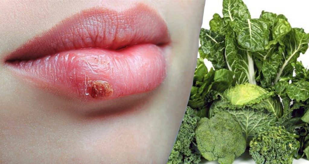 7-dangerous-yet-often-neglected-signs-of-folate-deficiency